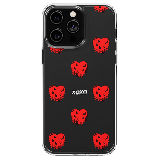 product Image of a phone case - xo